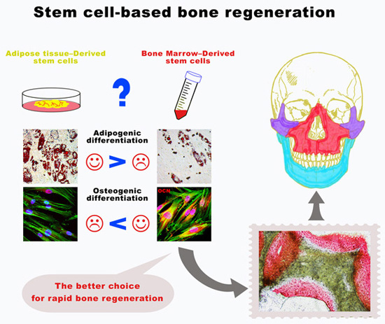 Stem cell-based bone regeneration