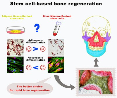 Stem cell-based bone regeneration